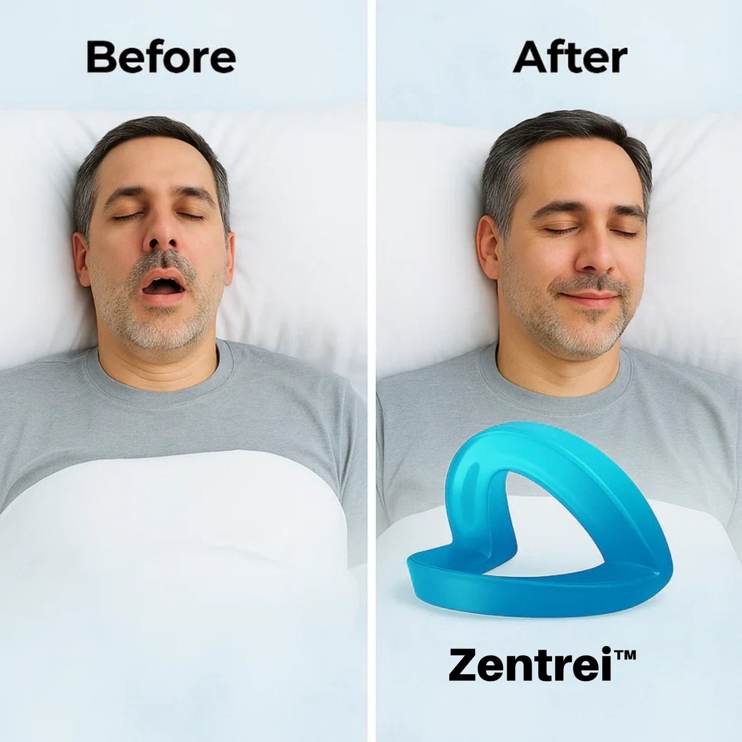 Zentrei™ - Snore Solution